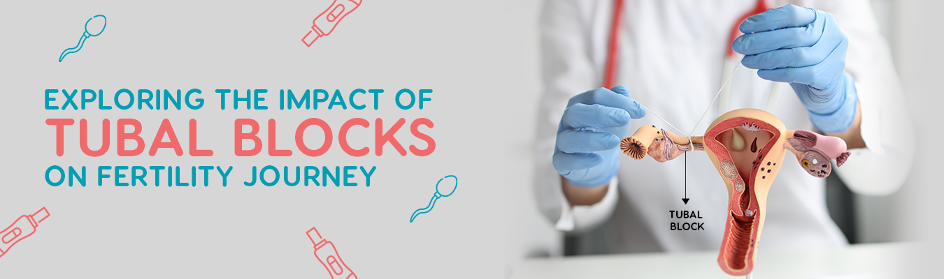 blog-detail-page-banner