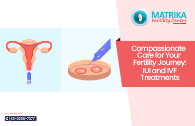 fertility treatment